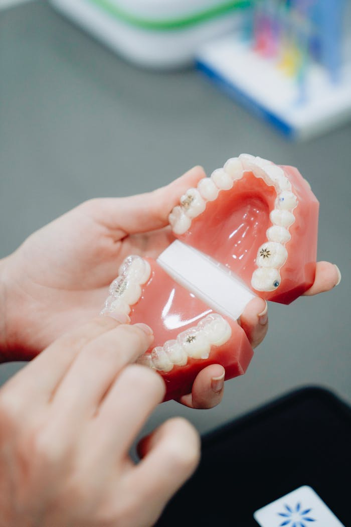 Close-up of hands holding and examining a dental cast with orthodontic brackets.